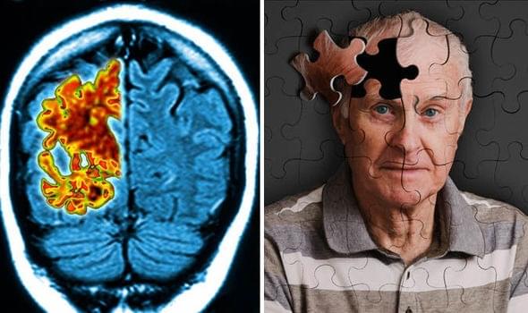 brain_fog_larry.jpg